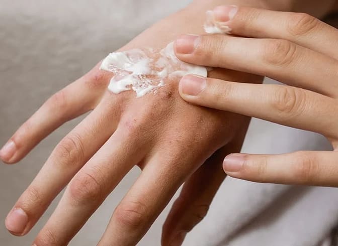 Råd om torr hud