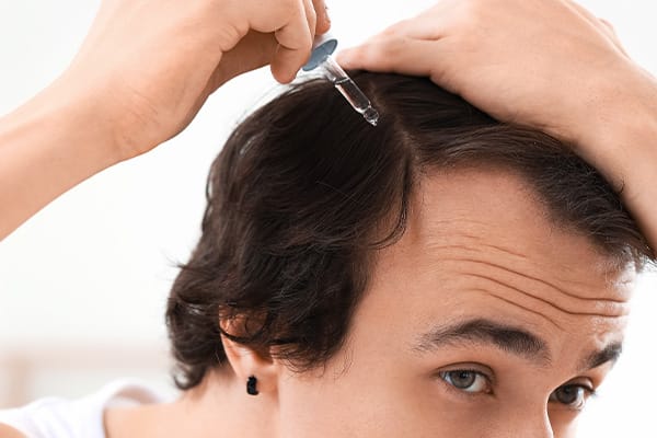 Person som upplever håravfall